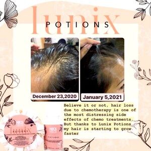 Hair Growth Treatment